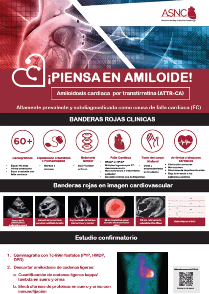 Poster piensa amiloide para cardiológos poster image
