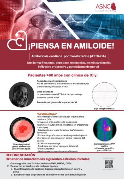 Poster piensa amiloide para laboratorios de ECO poster image